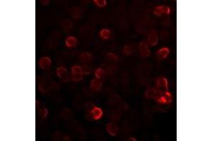Immunofluorescent analysis of S100-A12 staining in SW620 cells. (S100A12 抗体)