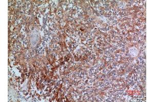 Immunohistochemistry (IHC) analysis of paraffin-embedded Human Brain, antibody was diluted at 1:100. (CGREF1 抗体  (N-Term))