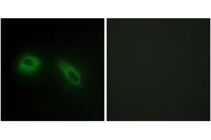 Immunofluorescence analysis of HeLa cells, using GLU2B Antibody. (PRKCSH 抗体  (AA 81-130))