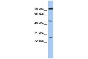 WB Suggested Anti-C1orf174 Antibody Titration: 0. (C1orf174 抗体  (Middle Region))