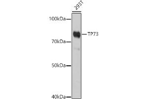Western blot analysis of extracts of 293T cells, using TP73 antibody (ABIN6133470, ABIN6149430, ABIN6149431 and ABIN6213831) at 1:1000 dilution. (Tumor Protein p73 抗体  (AA 1-100))