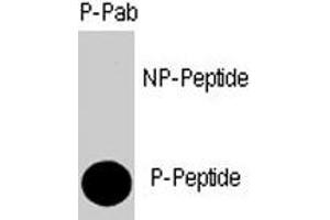 Dot blot analysis of SMAD4 (phospho T277) polyclonal antibody  on nitrocellulose membrane. (SMAD4 抗体  (Thr277))