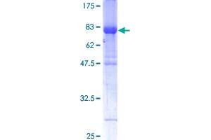 IRF6 Protein (AA 1-467) (GST tag)