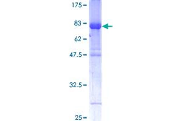 IRF6 Protein (AA 1-467) (GST tag)