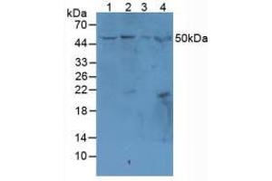 Figure. (MADCAM1 抗体  (AA 29-297))