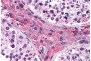 Human Testis (formalin-fixed, paraffin-embedded) stained with NR1H4 antibody ABIN214795 at 5 ug/ml followed by biotinylated goat anti-rabbit IgG secondary antibody ABIN481713, alkaline phosphatase-streptavidin and chromogen. (NR1H4 抗体  (AA 194-243))