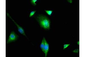 Immunofluorescence staining of U251 cells with ABIN7163202 at 1:100, counter-stained with DAPI.