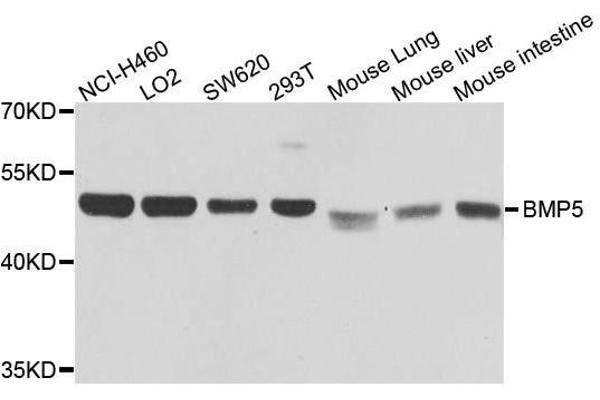 BMP5 抗体  (AA 317-454)