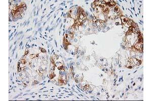 Image no. 9 for anti-BAI1-Associated Protein 2 (BAIAP2) antibody (ABIN1496805) (BAIAP2 抗体)