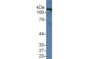 Western Blot; Sample: Human Serum; Primary Ab: 1µg/ml Rabbit Anti-Human UGGT2 Antibody Second Ab: 0. (UGCGL2 抗体  (AA 1221-1408))