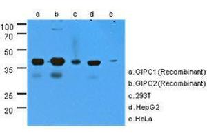 The cell lysates (40 ug) were resolved by SDS-PAGE, transferred to PVDF membrane and probed with GIPC antibody (1:1000). (GIPC1 抗体  (AA 1-315))