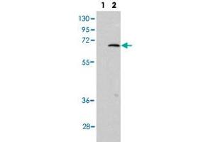 Western blot analysis of PIAS1 (arrow) using PIAS1 polyclonal antibody . (PIAS1 抗体  (C-Term))