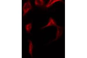 ABIN6269120 staining NIH-3T3 by IF/ICC. (c-MET 抗体  (Internal Region))