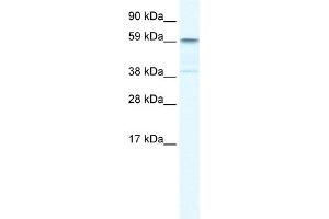 WB Suggested Anti-TRIM41 Antibody Titration:  0. (TRIM41 抗体  (C-Term))