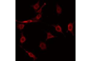 ABIN6274922 staining COLO205 by IF/ICC. (FAM203B 抗体  (Internal Region))