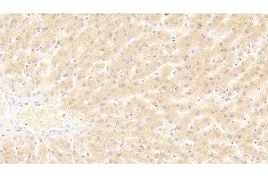 Detection of HNF4a in Human Liver Tissue using Polyclonal Antibody to Hepatocyte Nuclear Factor 4 Alpha (HNF4a) (HNF4A 抗体  (AA 131-330))