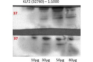 Western Blotting (WB) image for anti-Kruppel-Like Factor 2 (Lung) (KLF2) (Middle Region) antibody (ABIN2777573)