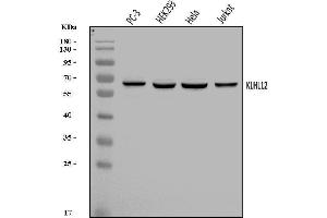 Western blot analysis of KLHL12 using anti-KLHL12 antibody (ABIN7601009).