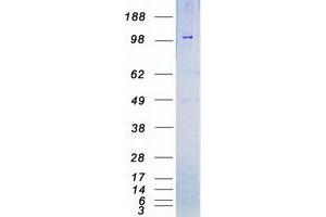 Western Blotting (WB) image for Bone Morphogenetic Protein Receptor, Type II (serine/threonine Kinase) (BMPR2) protein (Myc-DYKDDDDK Tag) (ABIN2715311)