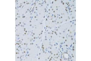 Immunohistochemistry of paraffin-embedded mouse pancreas using SNRNP70 antibody. (SNRNP70 抗体  (AA 150-250))