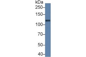Western Blot; Sample: Rat Cerebrum lysate; Primary Ab: 5µg/ml Rabbit Anti-Rat Slit1 Antibody Second Ab: 0. (SLIT1 抗体  (AA 611-791))