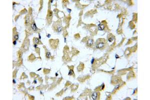 IHC analysis of paraffin-embedded human heart tissue, using SLN antibody (1/100 dilution, 40X lens). (SLN 抗体)
