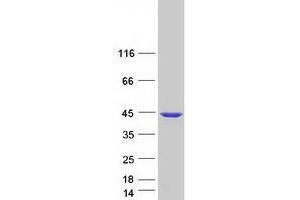 Western Blotting (WB) image for ZW10 Interactor (ZWINT) (Transcript Variant 2) protein (Myc-DYKDDDDK Tag) (ABIN2736191)