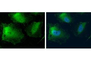 Immunofluorescence (IF) image for anti-Methylthioadenosine phosphorylase (MTAP) antibody (ABIN2856653)
