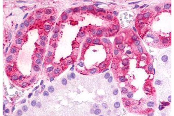 GPR175 抗体  (Cytoplasmic Domain)