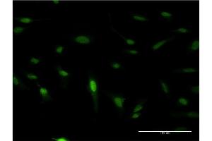 Immunofluorescence of monoclonal antibody to PDX1 on HeLa cell. (PDX1 抗体  (AA 109-208))
