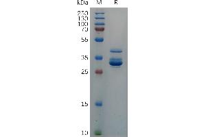 SDS-PAGE (SDS) image for Chemokine (C-X-C Motif) Ligand 10 (CXCL10) (AA 22-98) protein (Fc Tag) (ABIN7490675)