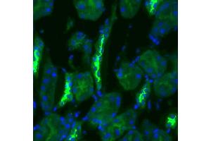 Immunohistochemistry (IHC) image for anti-Solute Carrier Family 12 (Sodium/Chloride Transporters), Member 3 (SLC12A3) (AA 74-95) antibody (HRP) (ABIN2486294)