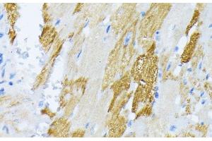 Immunohistochemistry of paraffin-embedded Rat heart using CALR Polyclonal Antibody at dilution of 1:100 (40x lens). (Calreticulin 抗体)