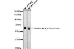 Western blot analysis of extracts of various cell lines, using TGF beta Receptor II (TGFBR2) antibody (ABIN6130736, ABIN6149086, ABIN6149089 and ABIN6218416) at 1:630 dilution. (TGFBR2 抗体  (AA 23-280))