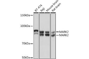 Western blot analysis of extracts of various cell lines, using M Rabbit mAb (ABIN7268397) at 1:1000 dilution. (MARK2 抗体)