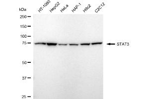 Western blotting analysis using STAT3 antibody (ABIN7800342).