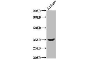 Western Blot Positive WB detected in: Rat kidney tissue All lanes: HOXA4 antibody at 2. (HOXA4 抗体  (AA 23-173))