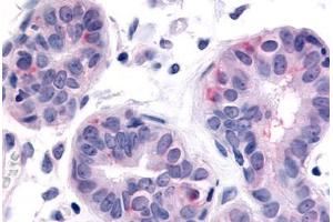 Anti-HUNK antibody  ABIN1048970 IHC staining of human breast. (HUNK 抗体  (Internal Region))