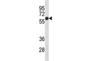 Placental Alkaline Phosphatase antibody western blot analysis in HepG2 lysate (Alkaline Phosphatase 抗体  (AA 56-83))