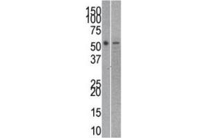anti-Reptin,TIP49B,RUVB2 antibody