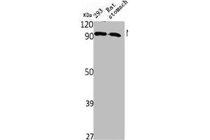 Western Blot analysis of rat stomach 293 cells using NPAS2 Polyclonal Antibody (NPAS2 抗体  (Internal Region))
