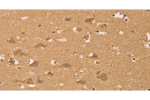 Immunohistochemistry of paraffin-embedded Human brain using HIF1AN Polyclonal Antibody at dilution of 1:40 (HIF1AN 抗体)
