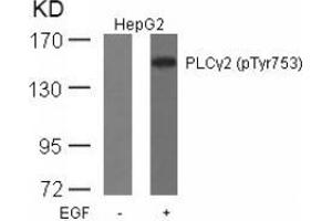 Image no. 1 for anti-Phospholipase C gamma 2 (PLCG2) (pTyr753) antibody (ABIN196906) (Phospholipase C gamma 2 抗体  (pTyr753))