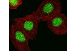 Fluorescent image of A549 cell stained with HMGA1 antibody at 1:25. (HMGA1 抗体  (AA 64-93))