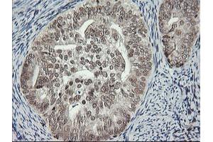 Image no. 1 for anti-Malignant T Cell Amplified Sequence 1 (MCTS1) (AA 1-181) antibody (ABIN1490598) (MCTS1 抗体  (AA 1-181))