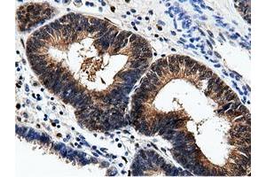Immunohistochemical staining of paraffin-embedded Human Kidney tissue using anti-AK5 mouse monoclonal antibody. (Adenylate Kinase 5 抗体)