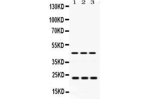 Western Blotting (WB) image for anti-RAB13, Member RAS Oncogene Family (RAB13) (AA 121-150), (C-Term) antibody (ABIN3043916)