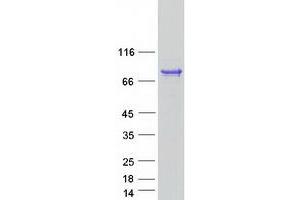 Western Blotting (WB) image for Archaelysin Family Metallopeptidase 1 (AMZ1) protein (Myc-DYKDDDDK Tag) (ABIN2714678)