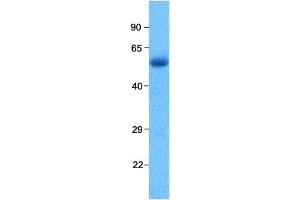 Western Blotting (WB) image for anti-SP140 Nuclear Body Protein (SP140) (N-Term) antibody (ABIN2777631)