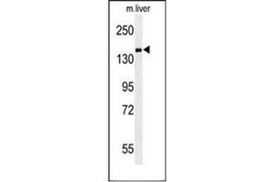 Western Blotting (WB) image for anti-phosphodiesterase 6C, CGMP-Specific, Cone, alpha Prime (PDE6C) (AA 278-308), (Middle Region) antibody (ABIN954067)